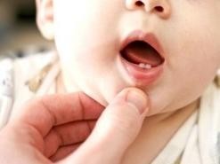 Eruptia dentara a bebelusului