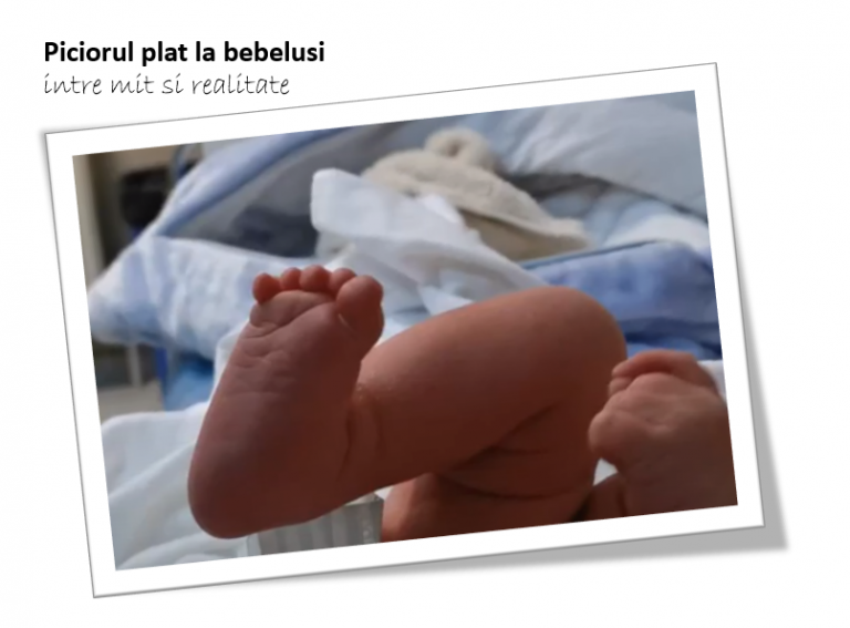 Picior plat la bebelusi: intre mit si realitate