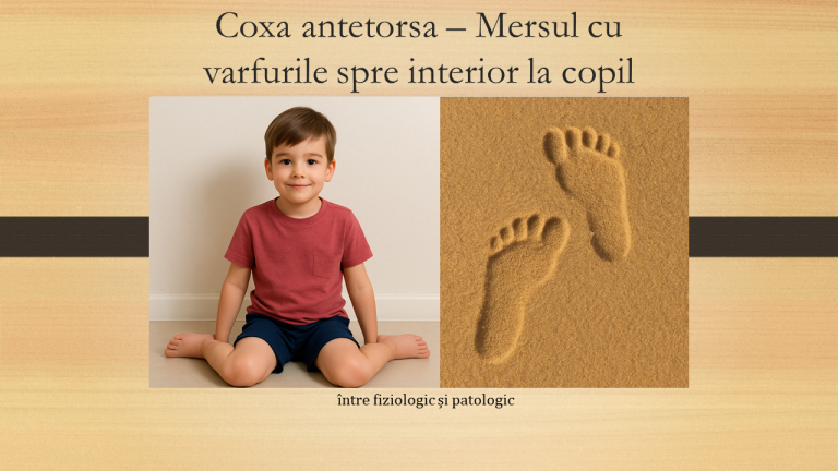 Coxa antetorsa – Mersul cu varfurile spre interior la copil: între fiziologic și patologic