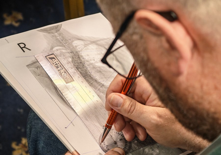 Curs de terapie Schroth pentru medici Medic care trasează liniile de măsurare a curburii pe o radiografie de coloană, la un curs de terapie Schroth