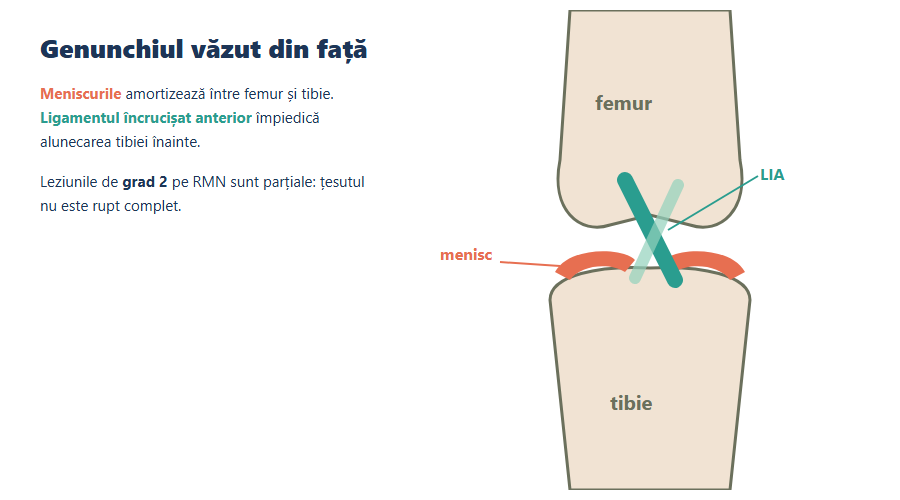 Meniscurile și ligamentul încrucișat anterior Schemă a genunchiului văzut din față, cu meniscurile și ligamentul încrucișat anterior