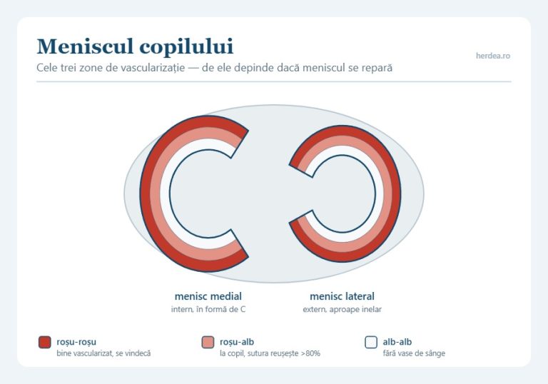 Cele trei zone de vascularizație ale meniscului la copil: roșu-roșu, roșu-alb și alb-alb