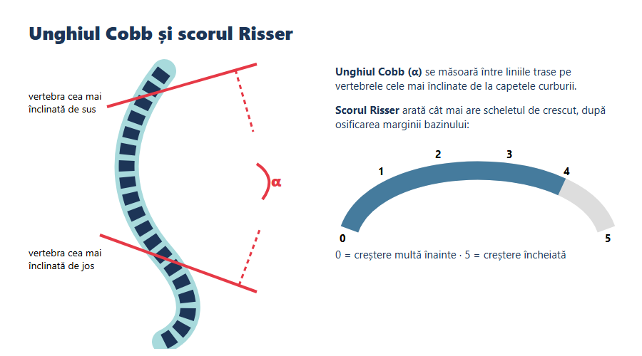 Unghiul Cobb și scorul Risser Schemă a coloanei cu scolioză, cu măsurarea unghiului Cobb și scala scorului Risser